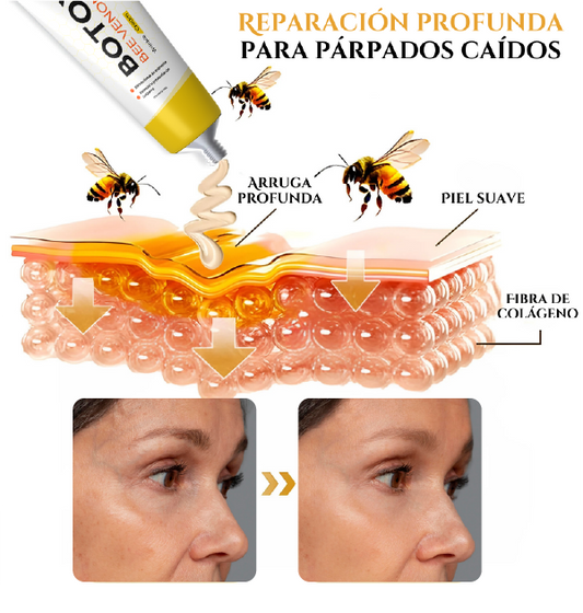 Botox bee venom - Dermabee (spray)