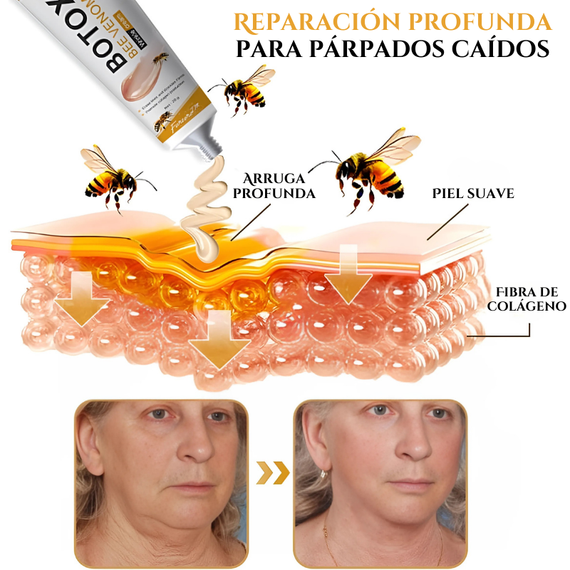 Botox bee venom TT