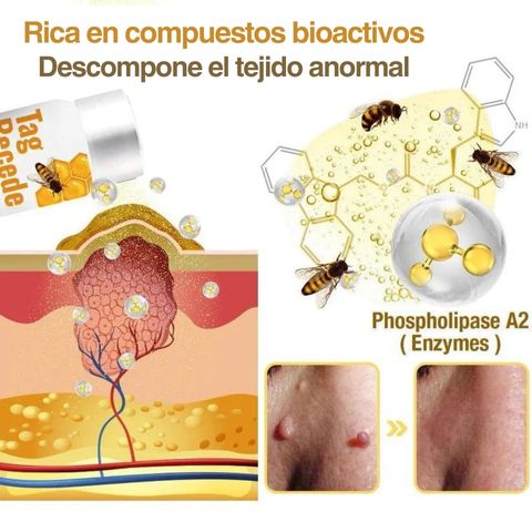Dermabee: Manchas en la piel