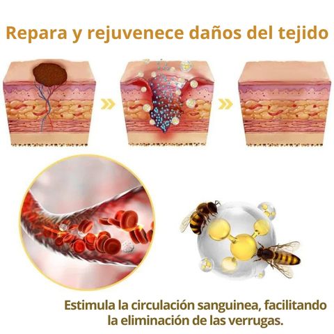 Dermabee - Manchas en la piel