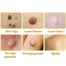 Dermabee: Manchas y verrugas en la piel