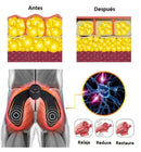 SMARTFIT - COLA PERFECTA