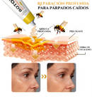 Botox bee venom - Dermabee